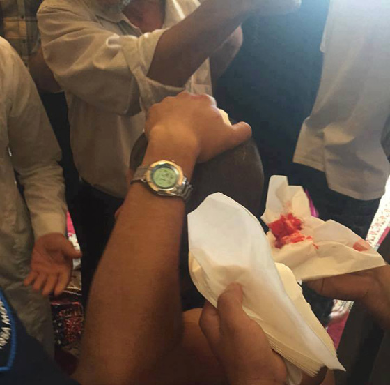 اقتحام مستوطنين للاقصى يسفر عن اصابات واعتقالات صورة رقم 3