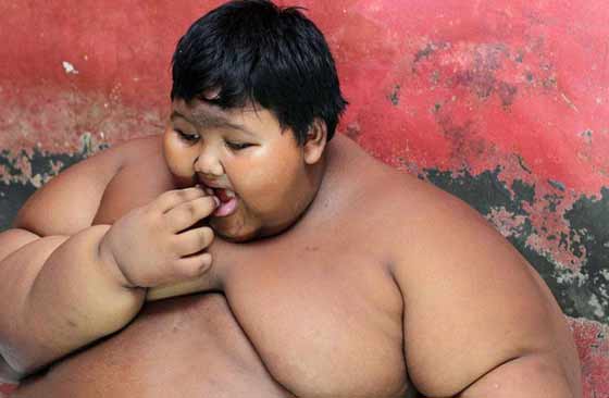 القصة الكاملة لاسمن طفل في العالم.. خضع لحمية مختلفة صورة رقم 1 القصة الكاملة لاسمن طفل في العالم.. خضع لحمية مختلفة صورة رقم 1