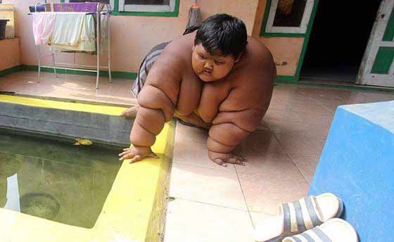 القصة الكاملة لاسمن طفل في العالم.. خضع لحمية مختلفة صورة رقم 4 القصة الكاملة لاسمن طفل في العالم.. خضع لحمية مختلفة صورة رقم 4