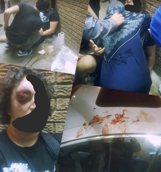 الاعتداء على شابين مسلمين اثناء خروجهما من مسجد نيويورك صورة رقم 2 الاعتداء على شابين مسلمين اثناء خروجهما من مسجد نيويورك صورة رقم 2