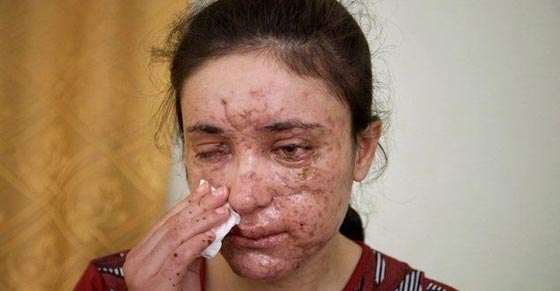 الدواعش يبيعون الجميلات العذراوات المختطفات بابخس الدولارات صورة رقم 3