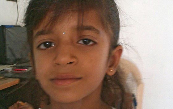 اكثر من الف نملة تعشش في اذن طفلة صغيرة.. شاهد الفيديو صورة رقم 3 اكثر من الف نملة تعشش في اذن طفلة صغيرة.. شاهد الفيديو صورة رقم 3