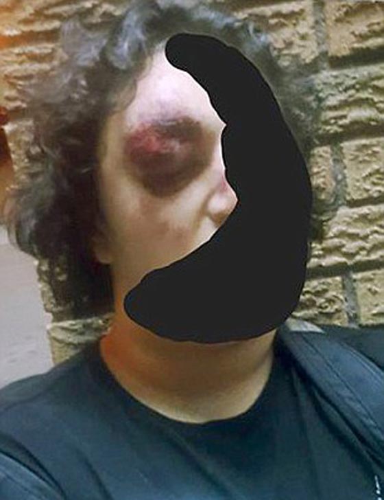 الاسلام جعله في قفص الاتهام.. الاعتداء على مسلم عند مسجد نيويورك صورة رقم 1 الاسلام جعله في قفص الاتهام.. الاعتداء على مسلم عند مسجد نيويورك صورة رقم 1