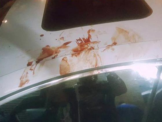 الاسلام جعله في قفص الاتهام.. الاعتداء على مسلم عند مسجد نيويورك صورة رقم 5 الاسلام جعله في قفص الاتهام.. الاعتداء على مسلم عند مسجد نيويورك صورة رقم 5