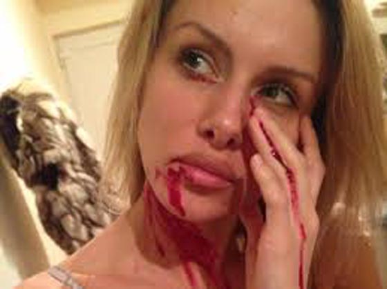 تهمة الشروع بالقتل تدخل ملكة جمال البوسنة الى السجن.. فيديو صورة رقم 6