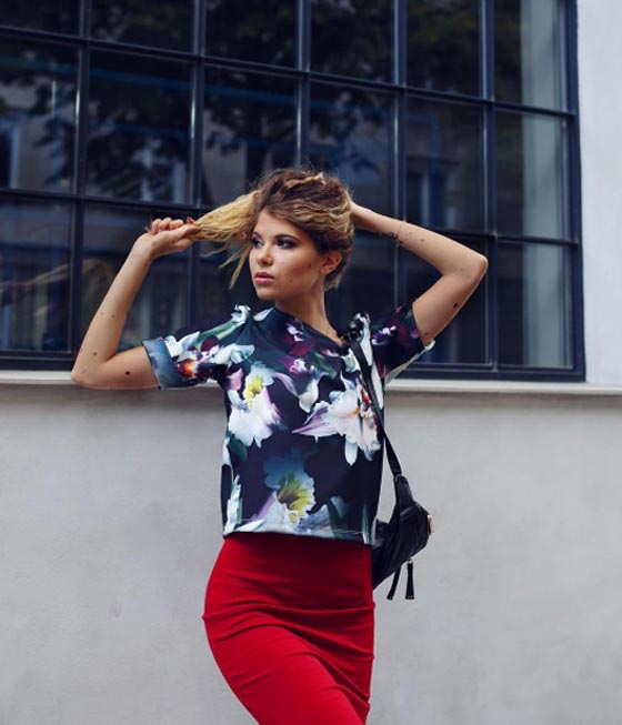 حسناء تغطي جسدها الوحمات وتتحدى بثقة كبيرة لقب الكلب المنقط! صورة رقم 8