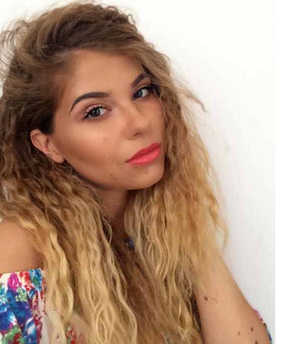 حسناء تغطي جسدها الوحمات وتتحدى بثقة كبيرة لقب الكلب المنقط! صورة رقم 9