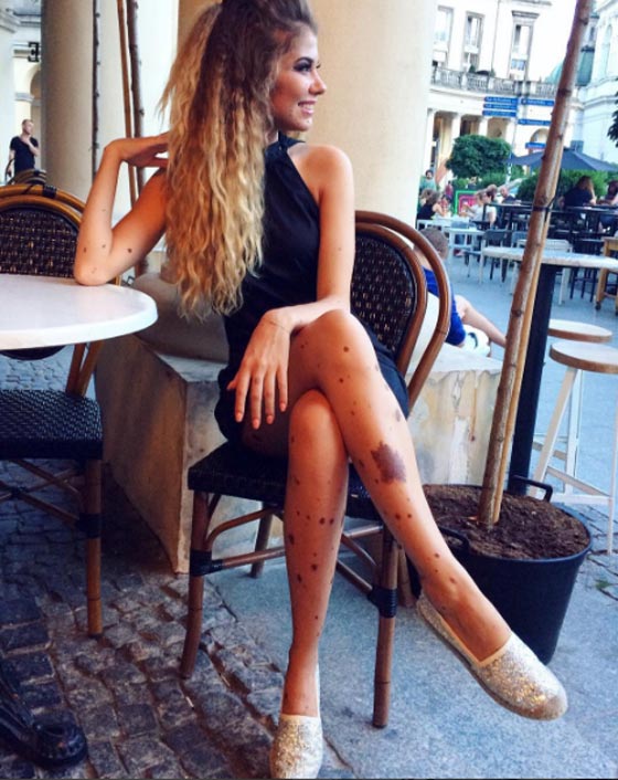 حسناء تغطي جسدها الوحمات وتتحدى بثقة كبيرة لقب الكلب المنقط! صورة رقم 10