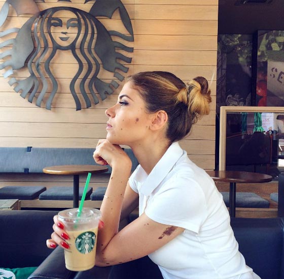 حسناء تغطي جسدها الوحمات وتتحدى بثقة كبيرة لقب الكلب المنقط! صورة رقم 12