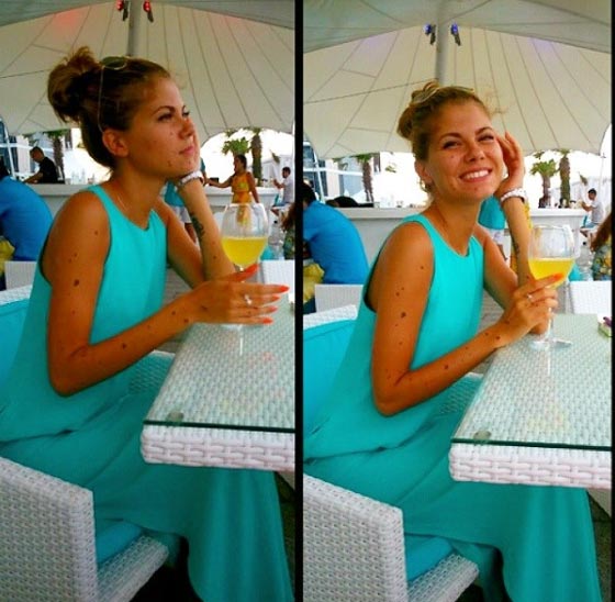 حسناء تغطي جسدها الوحمات وتتحدى بثقة كبيرة لقب الكلب المنقط! صورة رقم 15