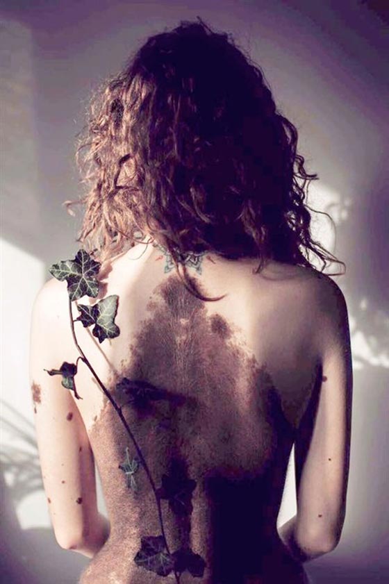 حسناء تغطي جسدها الوحمات وتتحدى بثقة كبيرة لقب الكلب المنقط! صورة رقم 2