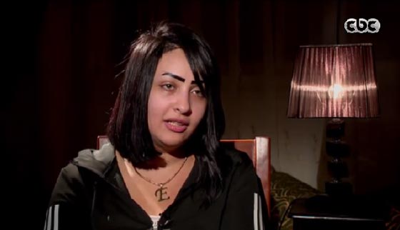 فيديو صادم: اجرت عملية تجميل شفط دهون فشوه الطبيب جسدها صورة رقم 5 فيديو صادم: اجرت عملية تجميل شفط دهون فشوه الطبيب جسدها صورة رقم 5