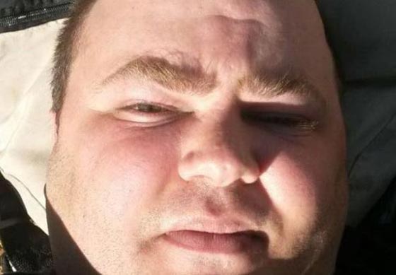  زعيم مافيا ايطالية يكسر كاحله قبل ان يقع في قبضة الشرطة صورة رقم 1