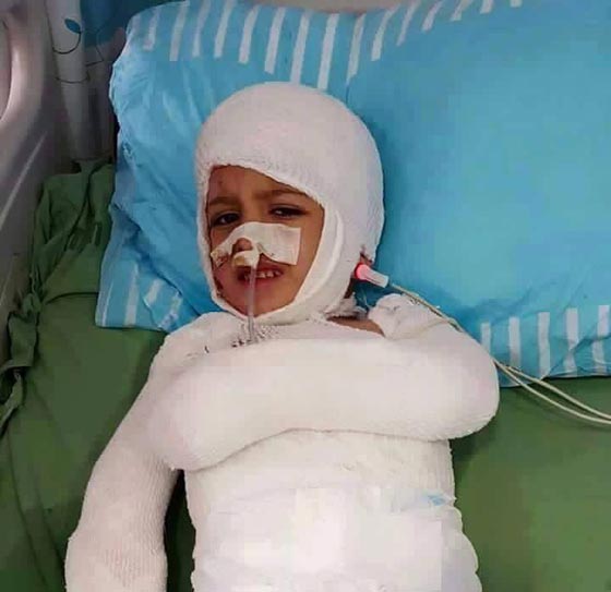 دوابشة.. الناجي الوحيد يعود الى بيته الجريح صورة رقم 8