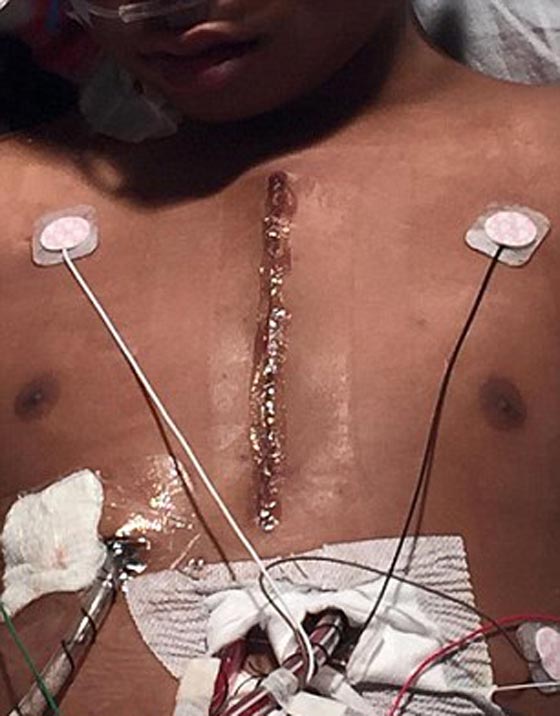 شاهد ما فعله الاب عندما استمع الى خفقان ابنته المتوفاة داخل صبي حي! صورة رقم 8 شاهد ما فعله الاب عندما استمع الى خفقان ابنته المتوفاة داخل صبي حي! صورة رقم 8