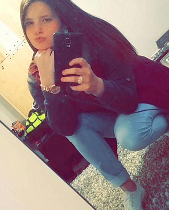 صور فتاة انفجرت في  وجهها سيجارة الكترونية صورة رقم 4