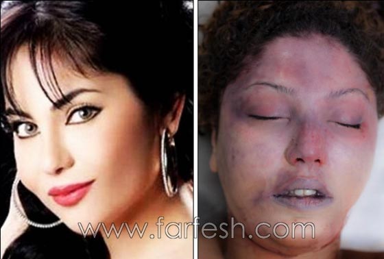 صور جريمة ذبح الفنّانة السورية شيندا خليل على يد شقيقها! صورة رقم 1