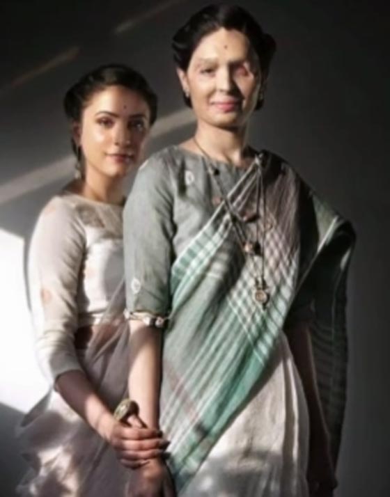 فتاة هندية مشوهه أصبحت وجها إعلاميا لمنع بيع المواد الحارقة!  صورة رقم 4