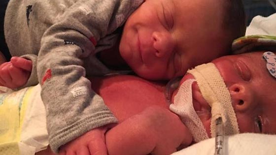 صورة مؤثرة أبكت الملايين: رضيع يحتضن شقيقه التوأم المتوفي  صورة رقم 5