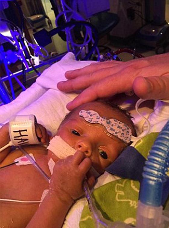 صورة مؤثرة أبكت الملايين: رضيع يحتضن شقيقه التوأم المتوفي  صورة رقم 3