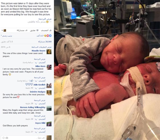 صورة مؤثرة أبكت الملايين: رضيع يحتضن شقيقه التوأم المتوفي  صورة رقم 1