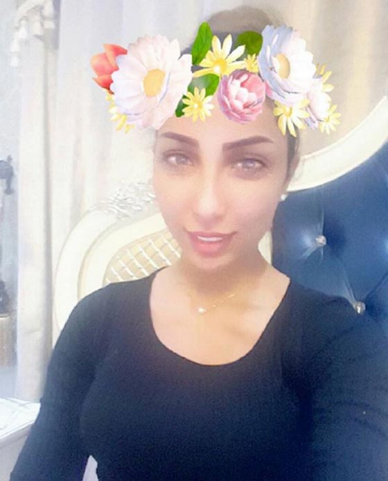 فيديو صادم: دنيا بطمة تحقن إبر البوتوكس في وجهها! صورة رقم 2