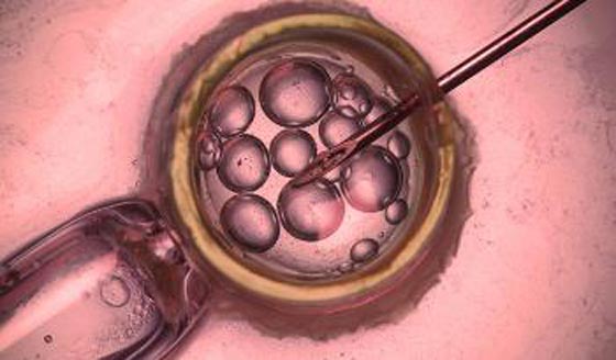 طبيب يلقح 70 امرأة بحيواناته المنوية في فضيحة هزت المجتمع الامريكي صورة رقم 8 طبيب يلقح 70 امرأة بحيواناته المنوية في فضيحة هزت المجتمع الامريكي صورة رقم 8