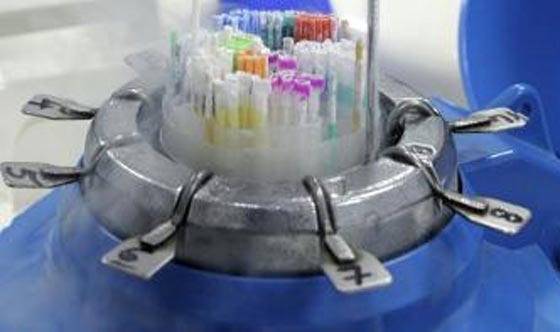 طبيب يلقح 70 امرأة بحيواناته المنوية في فضيحة هزت المجتمع الامريكي صورة رقم 9 طبيب يلقح 70 امرأة بحيواناته المنوية في فضيحة هزت المجتمع الامريكي صورة رقم 9