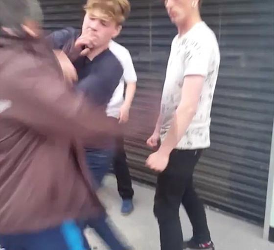 فيديو وصور.. مدمن يهاجم بوحشية مراهقا بمقص ويطعنه حتى يشله صورة رقم 2 فيديو وصور.. مدمن يهاجم بوحشية مراهقا بمقص ويطعنه حتى يشله صورة رقم 2