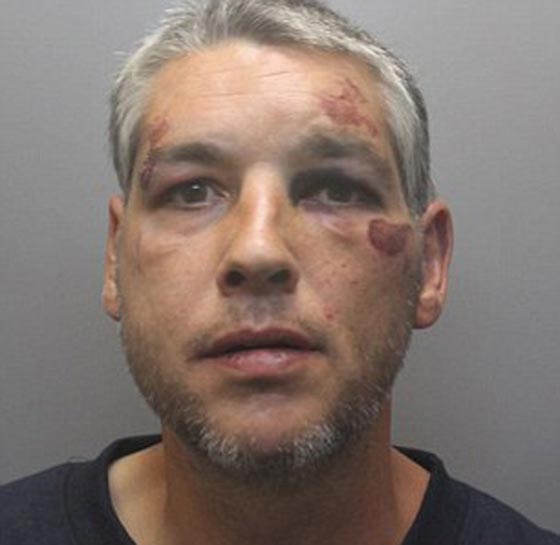 فيديو وصور.. مدمن يهاجم بوحشية مراهقا بمقص ويطعنه حتى يشله صورة رقم 3 فيديو وصور.. مدمن يهاجم بوحشية مراهقا بمقص ويطعنه حتى يشله صورة رقم 3