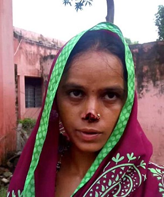 هندي مخمور يقطع أنف زوجته عقابا لاهلها لعدم دفع المهر! صورة رقم 1