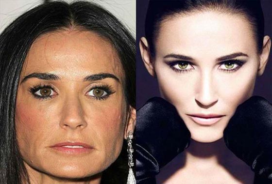 مشاهير يلجأون الى الفوتوشوب: سيدهشك الفرق في صور قبل وبعد التعديل! صورة رقم 7