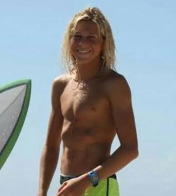 فيديو مؤلم: قرش عملاق يهاجم متزلج مراهق وبقضم ساقه بأسنانه الوحشية! صورة رقم 2 فيديو مؤلم: قرش عملاق يهاجم متزلج مراهق وبقضم ساقه بأسنانه الوحشية! صورة رقم 2