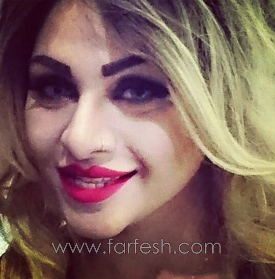 فيديو فنانة كويتية شهيرة تفضح زوجها بعد ان ضربها ضرباً مبرحاً صورة رقم 4