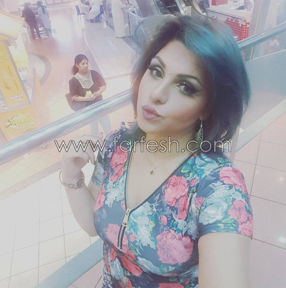 فيديو فنانة كويتية شهيرة تفضح زوجها بعد ان ضربها ضرباً مبرحاً صورة رقم 11