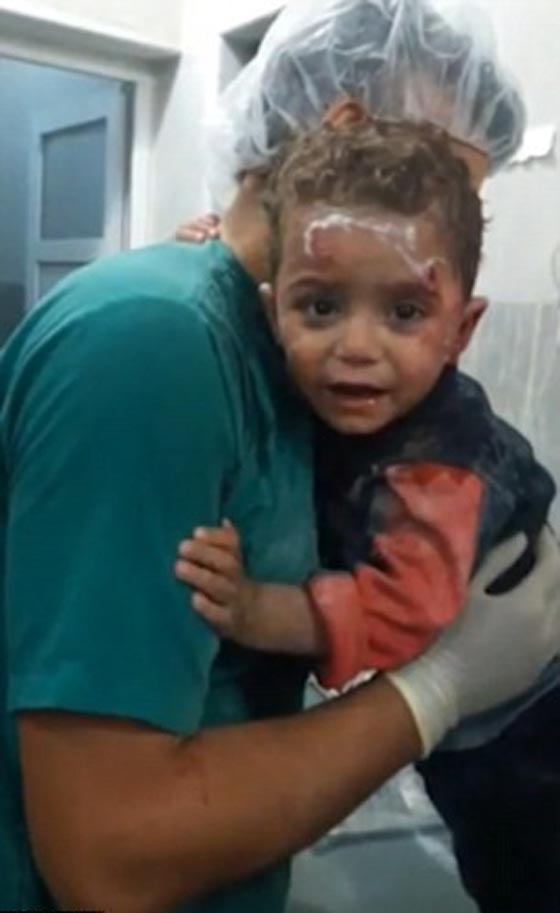 صراخ طفل سوري يحطم القلوب وهو يتشبث بممرض في حلب.. فيديو صورة رقم 2