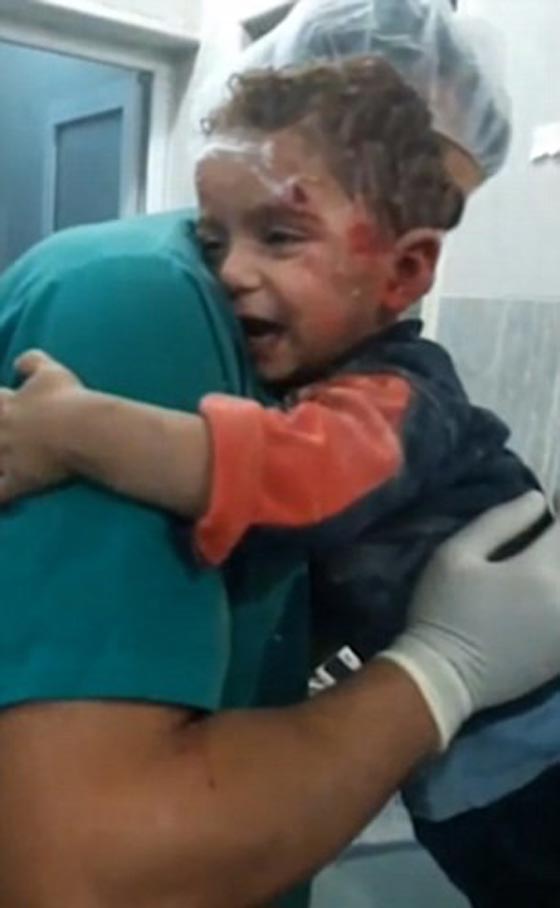 صراخ طفل سوري يحطم القلوب وهو يتشبث بممرض في حلب.. فيديو صورة رقم 3