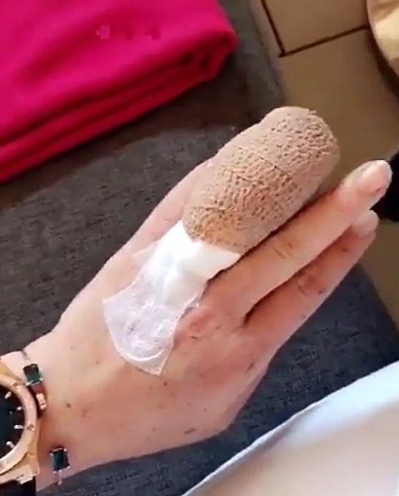 صور ليندسى لوهان بنصف أصبع بعد حادث بقارب في تركيا صورة رقم 1