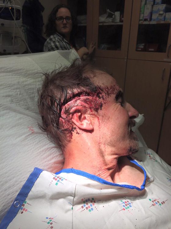  فيديو الدببة يحظى بملايين المشاهدات ومؤسس الفيسبوك يضغط لايك صورة رقم 2