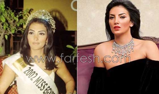 صور فنانات اجرين عمليات تجميل فاشلة نجم عنها التشويه الشلل والوفاة  صورة رقم 6