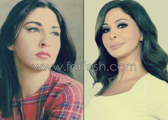صور فنانات اجرين عمليات تجميل فاشلة نجم عنها التشويه الشلل والوفاة  صورة رقم 14