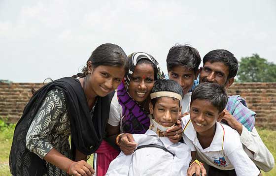 متبرعة بريطانية تنقذ الطفل صاحب الرقبة الملتوية ليعيش حياة طبيعية صورة رقم 1