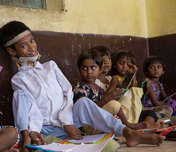 متبرعة بريطانية تنقذ الطفل صاحب الرقبة الملتوية ليعيش حياة طبيعية صورة رقم 5