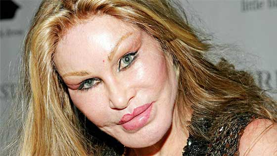  أموال طائلة أنفقها هؤلاء النجوم والمشاهير على عمليات التجميل  صورة رقم 10