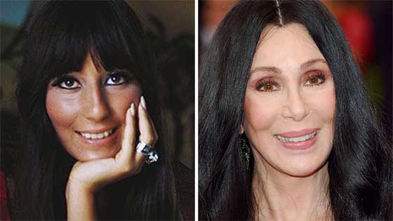  أموال طائلة أنفقها هؤلاء النجوم والمشاهير على عمليات التجميل  صورة رقم 7