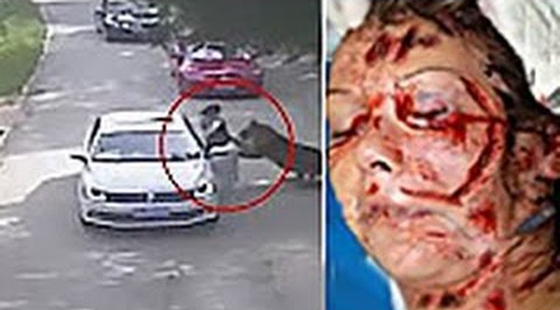 صينية تقاضي ادارة حديقة حيوان بعد ان هاجمها نمر.. فيديو صورة رقم 1 صينية تقاضي ادارة حديقة حيوان بعد ان هاجمها نمر.. فيديو صورة رقم 1