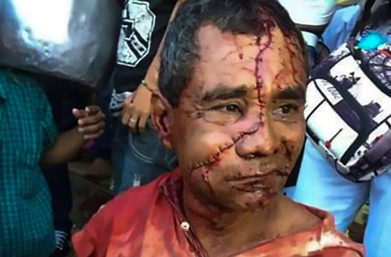 ثور هائج يحول وجه مصارع الى خريطة بعد اصابة خطيرة صورة رقم 1