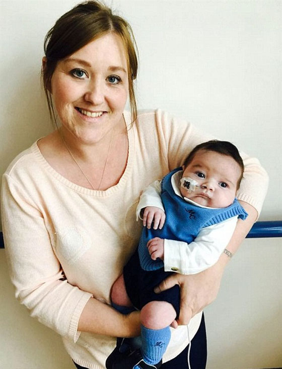 عملية جراحية معقدة لطفل عمره 4 ايام ولد بنصف قلب.. صور صورة رقم 4 عملية جراحية معقدة لطفل عمره 4 ايام ولد بنصف قلب.. صور صورة رقم 4