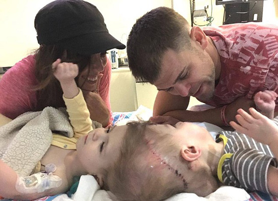 صور عملية جراحية نادرة لفصل توأم ملتصق من الرأس صورة رقم 2 صور عملية جراحية نادرة لفصل توأم ملتصق من الرأس صورة رقم 2