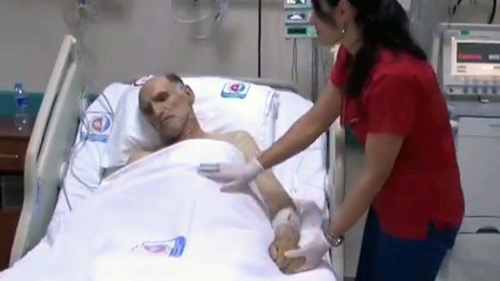 فيديو مريض استيقظ بغني بعد عملية في القلب توقف فيها قلبه 40 مرة صورة رقم 2 فيديو مريض استيقظ بغني بعد عملية في القلب توقف فيها قلبه 40 مرة صورة رقم 2